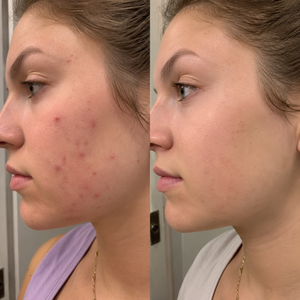 Before and after the 21-day Emerald ritual