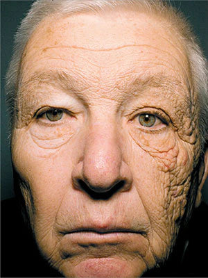 Sunscreen is a shield. This algae built something smarter.