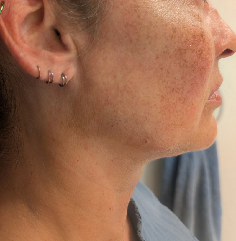 Algae Aura customer with hydrated, glowing skin